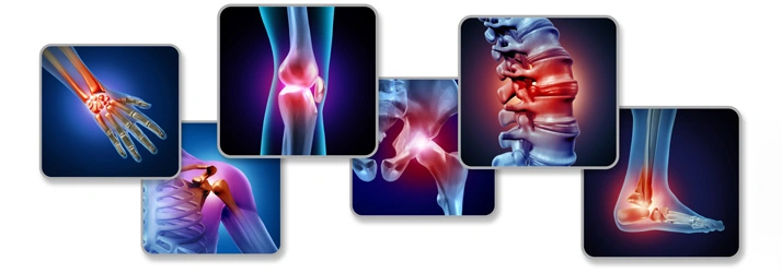 Illustrations showing pain or inflammation in various joints, including the wrist, knee, spine, shoulder, hip, and ankle.
