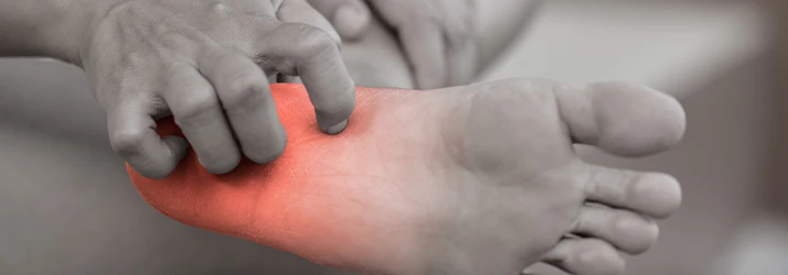 A close-up of a foot with the arch area highlighted in red, indicating pain or inflammation, possibly related to plantar issues.